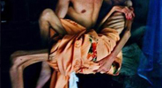 艾滋病患病情況（組圖）