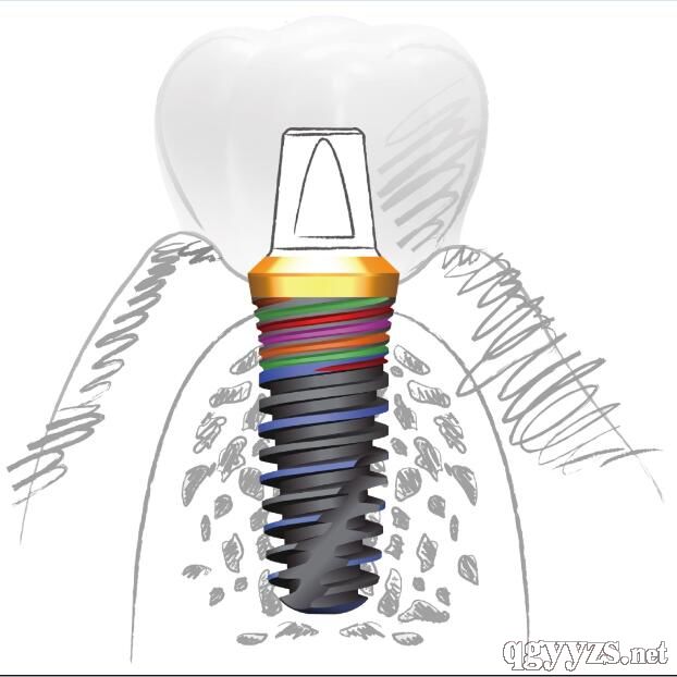 ���M(j��n)�ڡ�Ti-Star�Nֲ�wϵ�y(t��ng)����ǻ�Nֲ�w���˹�