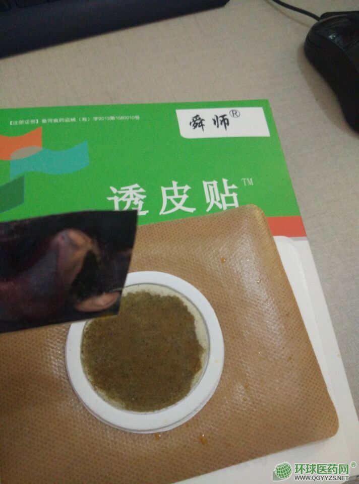 ɳ����͸Ƥ�N���a(ch��n)�S���N�ƴ��ӹ��S�����l(f��)�a(ch��n)Ʒ�DƬ